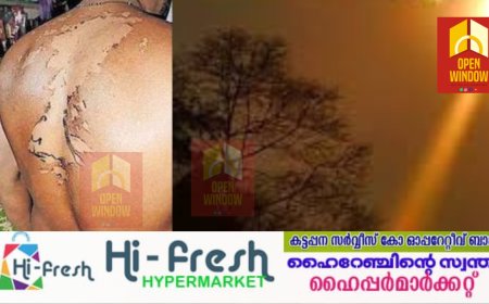 ഇടുക്കി വാഴത്തോപ്പിൽ യുവാവിനു
സൂര്യാതപമേറ്റു