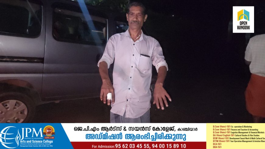 കാട്ടുപന്നി ആക്രമണത്തിൽ അയ്യപ്പൻകോവിൽ സ്വദേശിക്ക് പരുക്ക്