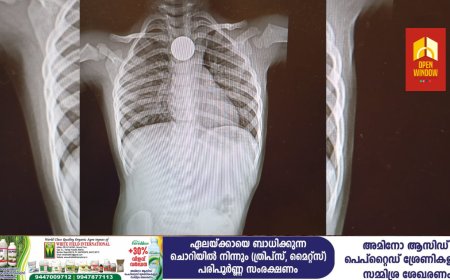 പിഞ്ചുകുഞ്ഞ് അബദ്ധത്തിൽ വിഴുങ്ങിയ നാണയം പാലാ മാർ സ്ലീവാ മെഡിസിറ്റിയിൽ നടത്തിയ ചികിത്സയിൽ പുറത്തെടുത്തു
