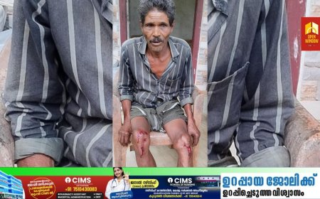 ഉപ്പുതറ കണ്ണംപടിയിൽ
ഒറ്റയാൻ്റെ മുന്നിൽപ്പെട്ട  വയോധികൻ ഓടി രക്ഷപെടുന്നതിനിടെ വീണു പരിക്കേറ്റു