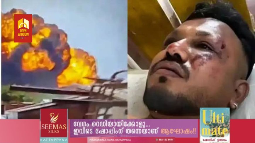 'ഞാന് എങ്ങനെ ജീവിച്ചിരിക്കുന്നുവെന്നറിയില്ല'; അഹമ്മദാബാദ് വിമാനാപകടത്തില് നിന്നും രക്ഷപ്പെട്ട യുവാവ്.ഫോണ് പോലും നഷ്ടപ്പെട്ടില്ല, വൻദുരന്തത്തില് നിന്ന് വിശ്വാസ് കുമാര് രക്ഷപ്പെട്ടതെങ്ങനെ