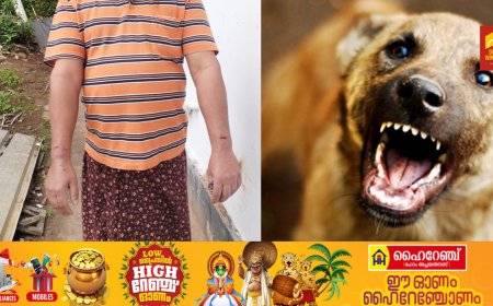 കട്ടപ്പന വള്ളക്കടവിൽ തെരുവുനായ ആക്രമണം; ഒരാൾക്ക് കടിയേറ്റു