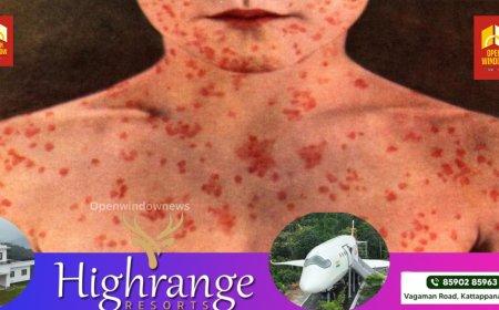 *ചിക്കന്‍പോക്‌സ്:  ലക്ഷണങ്ങള്‍ കണ്ടാലുടന്‍ ചികിത്സ തേടണമെന്ന് ആരോഗ്യ വകുപ്പ്*