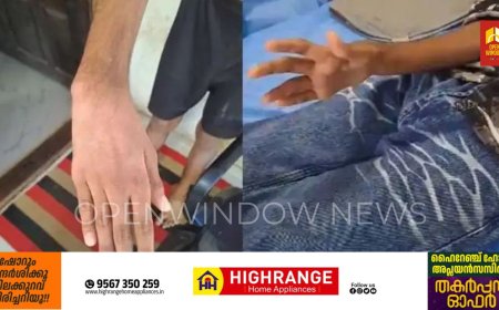 കൈ തനിയെ നേരെ ആയിക്കോളും; കോന്നിയിലേത് ചെറിയ സാധാരണ മെഡിക്കല്‍ കോളേജ്; ചികിത്സ പിഴവില്‍ വിചിത്ര വിശദീകരണവുമായി സൂപ്രണ്ട്