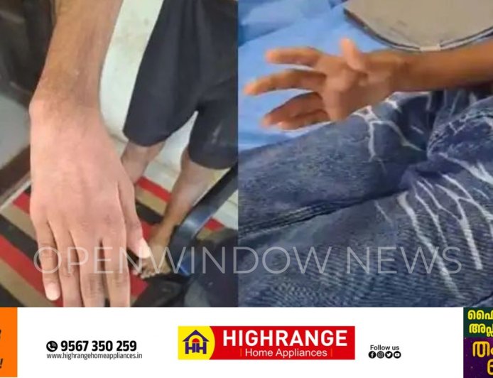 കൈ തനിയെ നേരെ ആയിക്കോളും; കോന്നിയിലേത് ചെറിയ സാധാരണ മെഡിക്കല്‍ കോളേജ്; ചികിത്സ പിഴവില്‍ വിചിത്ര വിശദീകരണവുമായി സൂപ്രണ്ട്