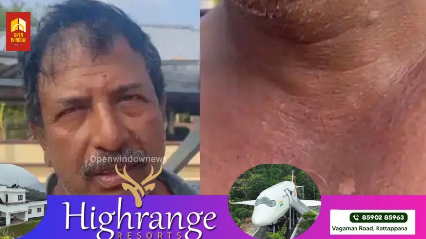 തിരുവല്ലയില്‍ റൂഫിംഗ് തൊഴിലാളിക്ക് സൂര്യാഘാതം ഏറ്റു