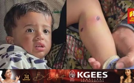 സിഗരറ്റ് കുറ്റികൊണ്ട് ഒന്നരവയസ്സുകാരന്റെ ദേഹം പൊള്ളിച്ചു... കാലില്‍ ആണി കുത്തിക്കയറ്റി' കണ്ണില്ലാ സയണിസ്റ്റ് ക്രൂരത