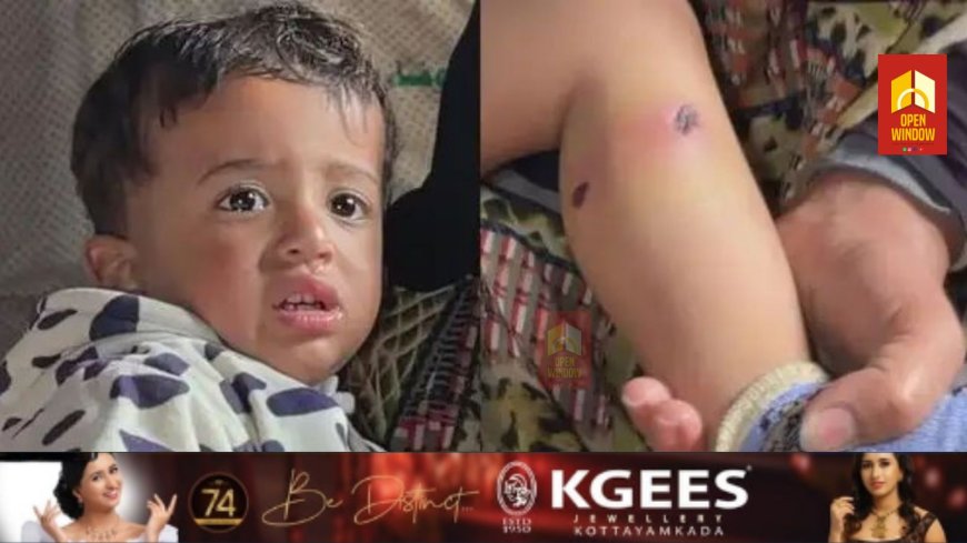 സിഗരറ്റ് കുറ്റികൊണ്ട് ഒന്നരവയസ്സുകാരന്റെ ദേഹം പൊള്ളിച്ചു... കാലില്‍ ആണി കുത്തിക്കയറ്റി' കണ്ണില്ലാ സയണിസ്റ്റ് ക്രൂരത