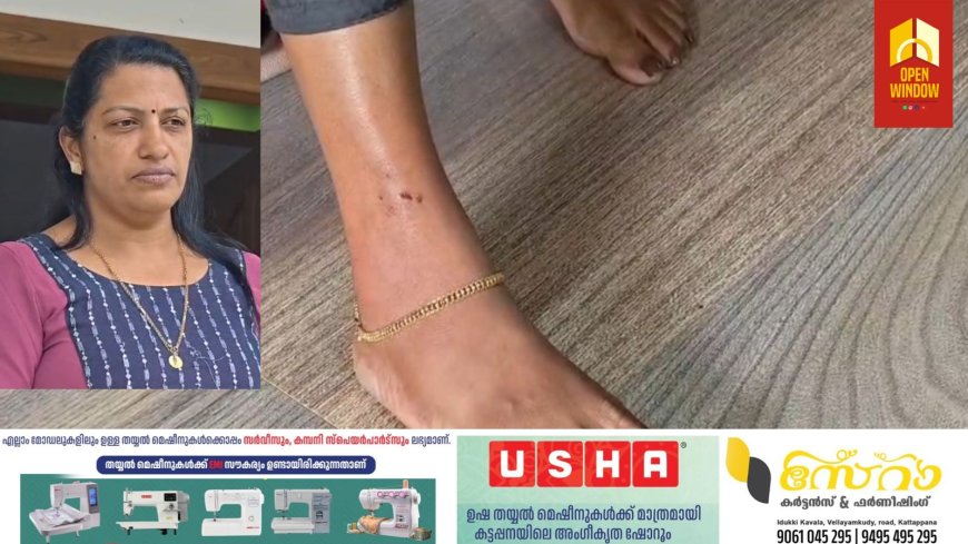 സെൻസസ് വിവരശേഖരണത്തിനിടെ കട്ടപ്പനയിൽ അധ്യാപികയ്ക്ക് വളർത്തുനായുടെ കടിയേറ്റു. വെള്ളയാംകുടി സെൻ്റ് ജേറോംസ് യു.പി. സ്കൂളിലെ അധ്യാപിക  പുളിയന്മല വാഴചാരിയിൽ ജിഷാ പി. മാണിക്കാണ് പരിക്കേറ്റത്.
